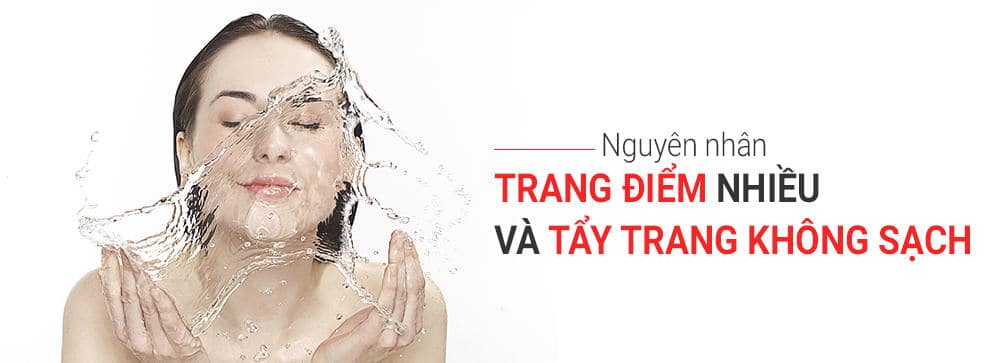 Lỗ chân lông to ở mũi và má do tẩy trang